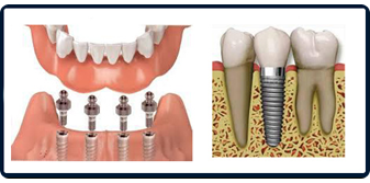 Clínica Dental Dr. Cuesta Cuesta ortodoncia